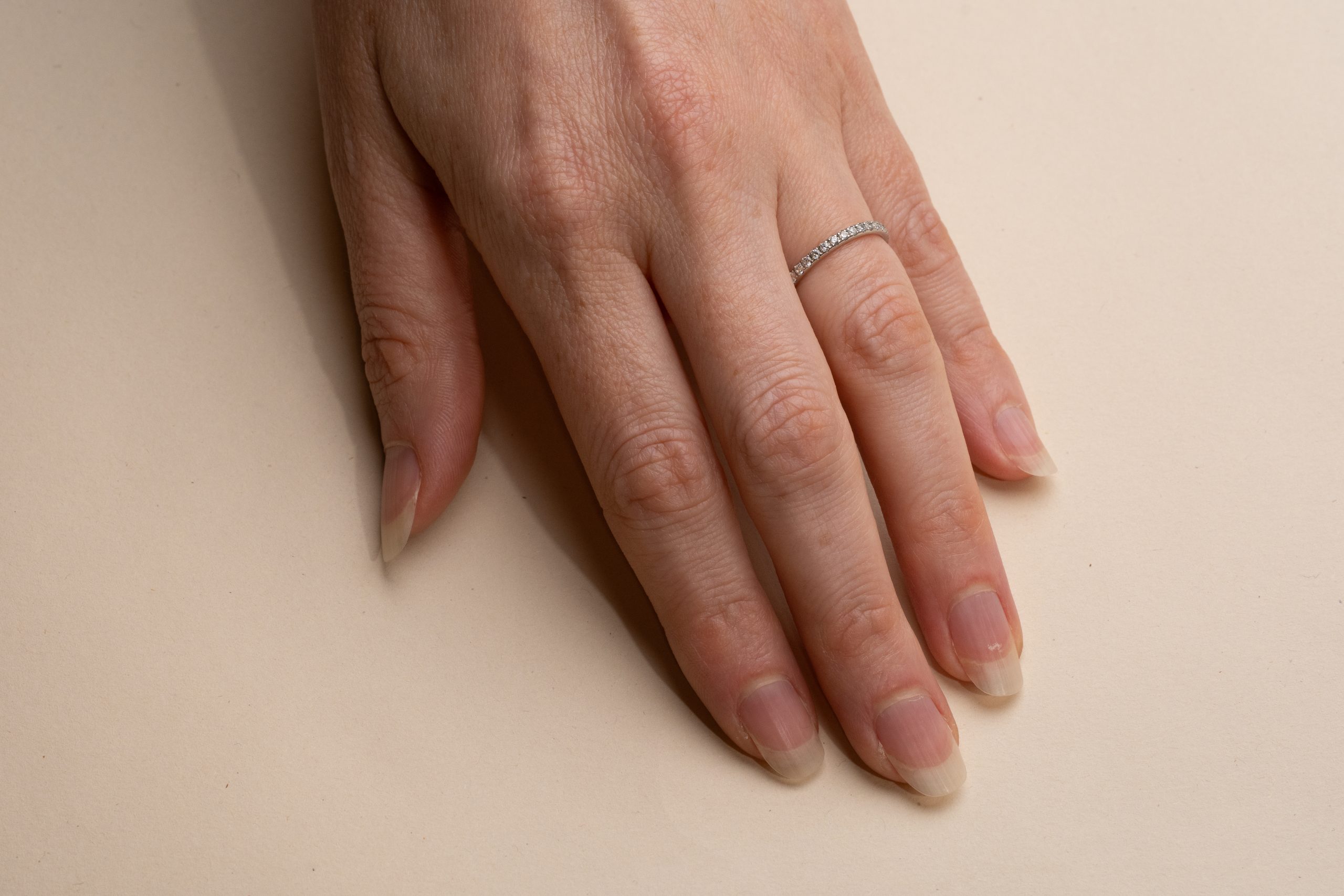 Alliansring Adina, 0015