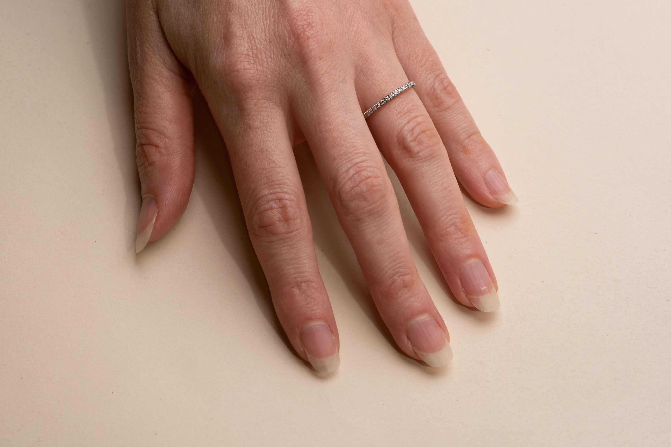 Alliansring Olympia 001